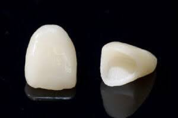 セラミッククラウン